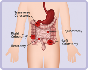 Intestine graphic