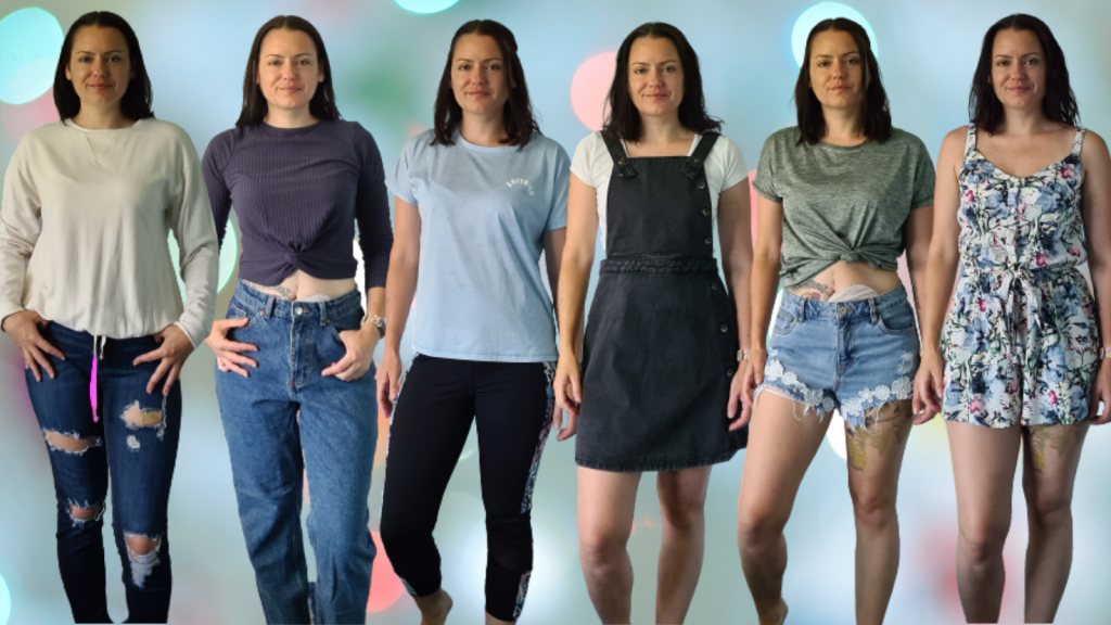 What to wear with an ostomy bag. Images of Sahara Fleetwood-Beresford in various outfits.