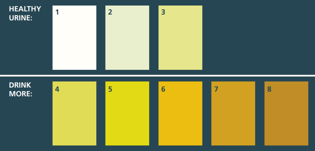 A chart shwoing healthy to poor urine colours