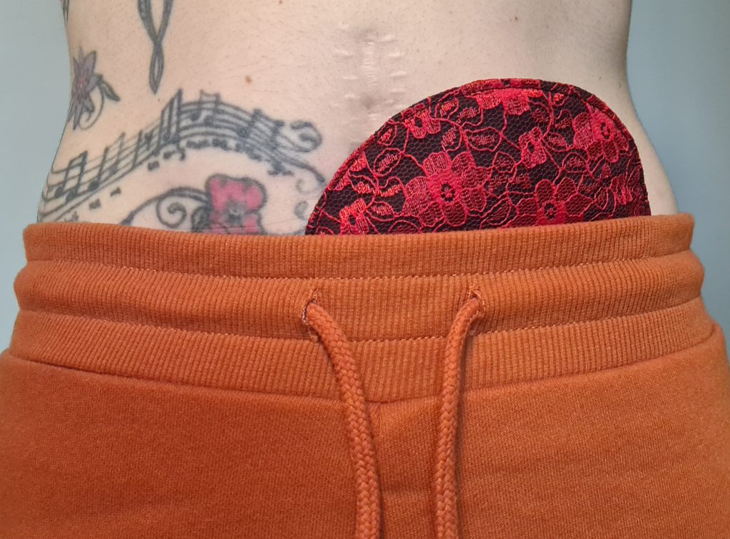 Sahara wears a colourfully designed stoma bag cover in black and red lace